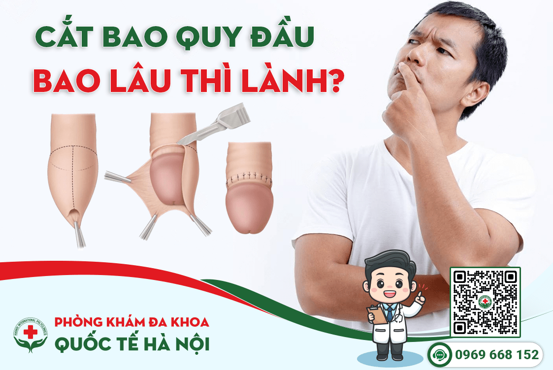 Cắt bao quy đầu bao lâu thì lành, cách chăm sóc và vệ sinh