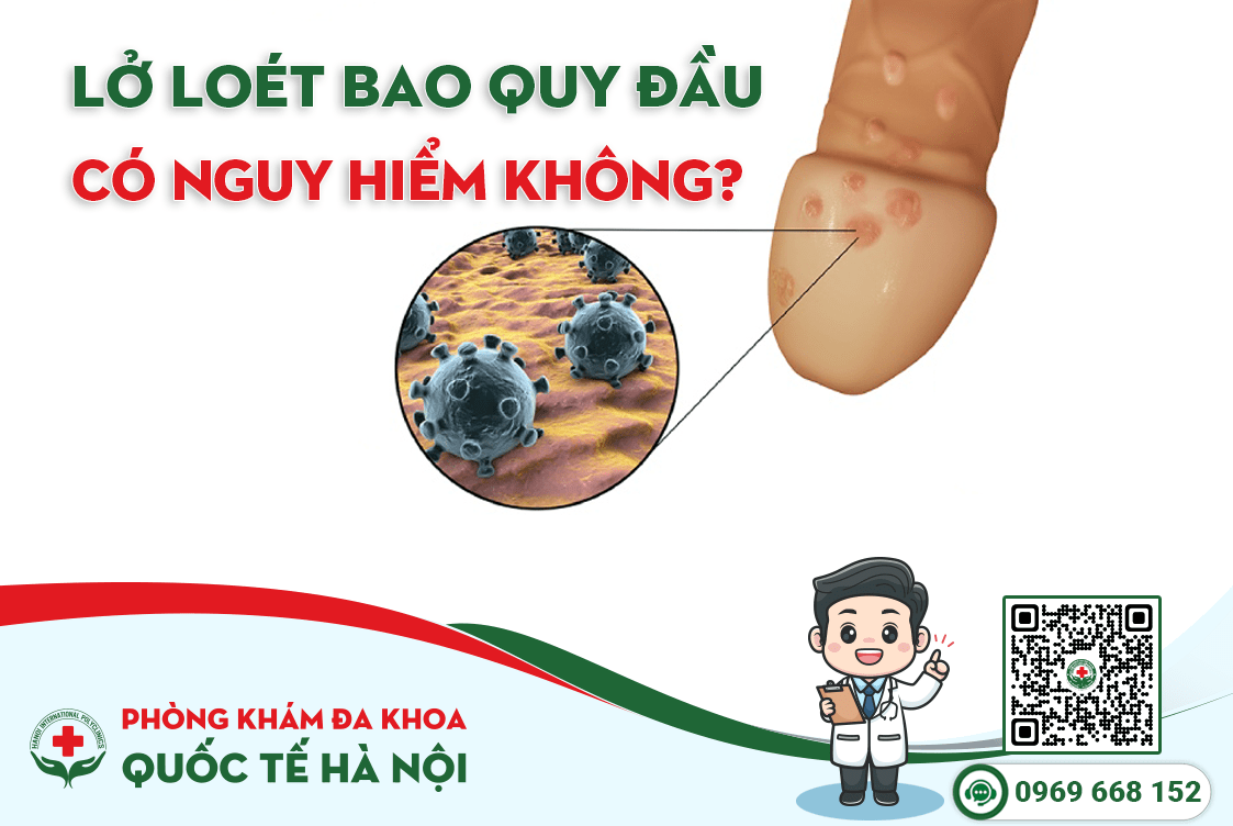 Nguyên nhân khiến bao quy đầu lở loét, gây khó chịu