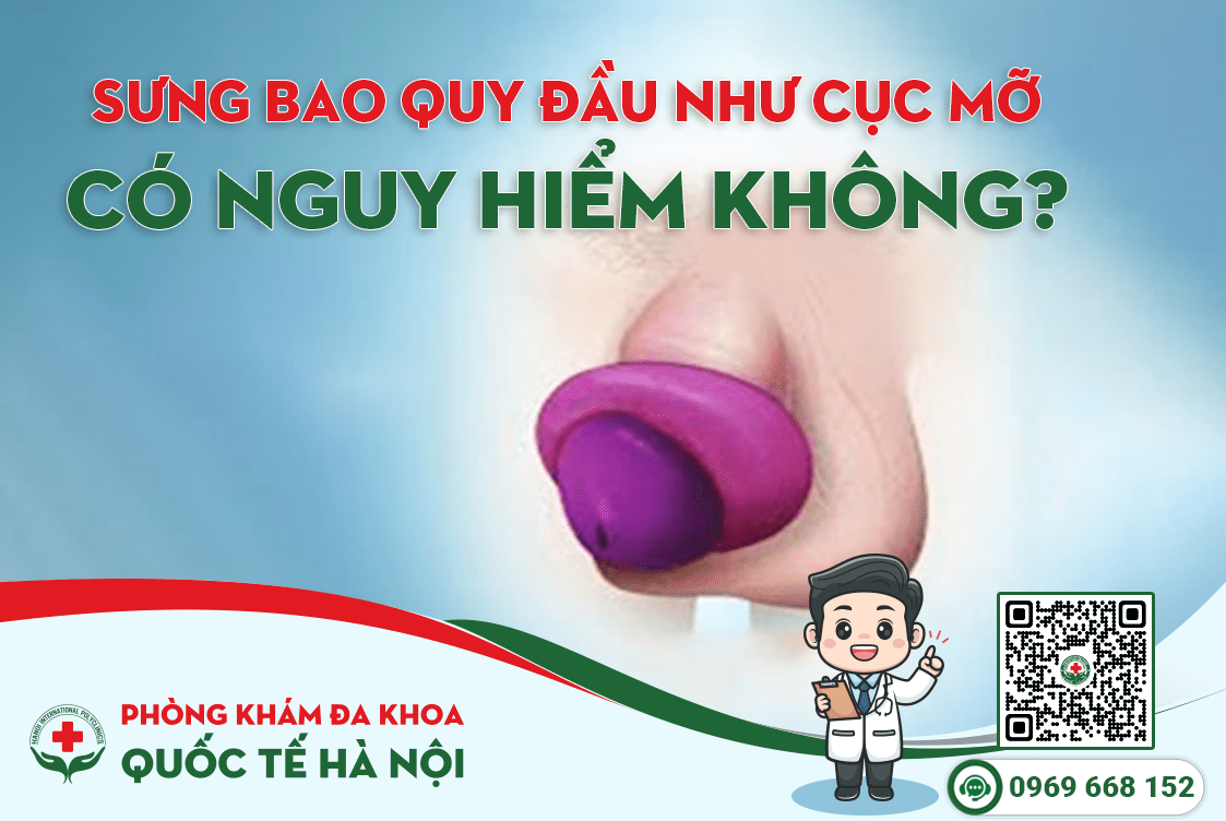 Nguyên nhân và dấu hiệu bao quy đầu sưng như cục mỡ